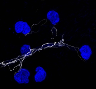 Nerves attached to the glomeruli in the kidneys